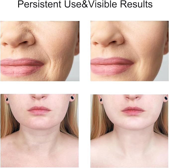 Masajeador Facial Reductor De Arrugas